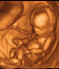 Három kicsi angyalkánk